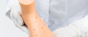 Relieving Arthritis Pain: The Power of Cannabis