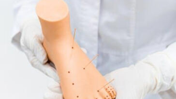 Relieving Arthritis Pain: The Power of Cannabis